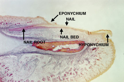 hyponychium histology