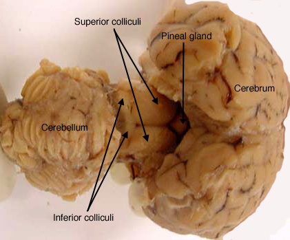 Sheep Brain