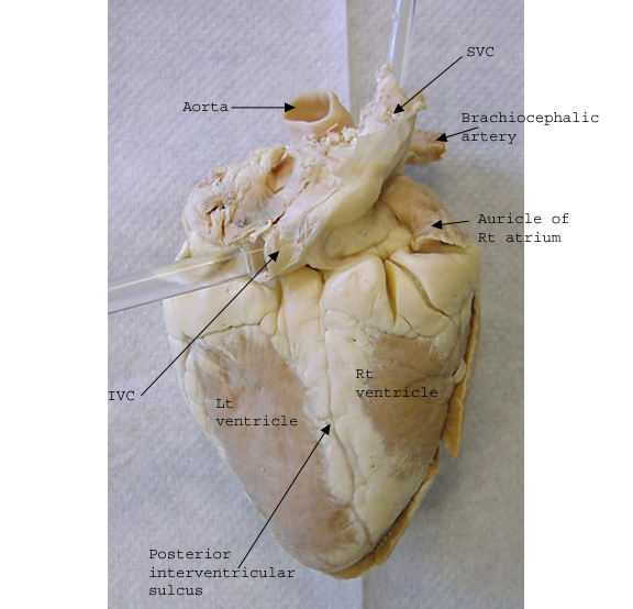 Anterior View Of Sheep Heart Labeled - Home Alqu