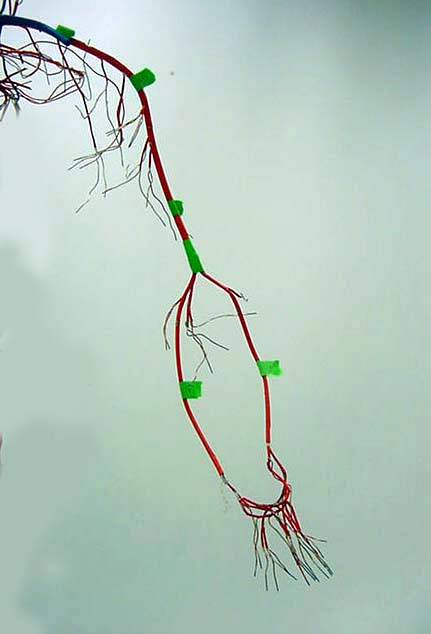 arteries and veins in arm. Arm Veins
