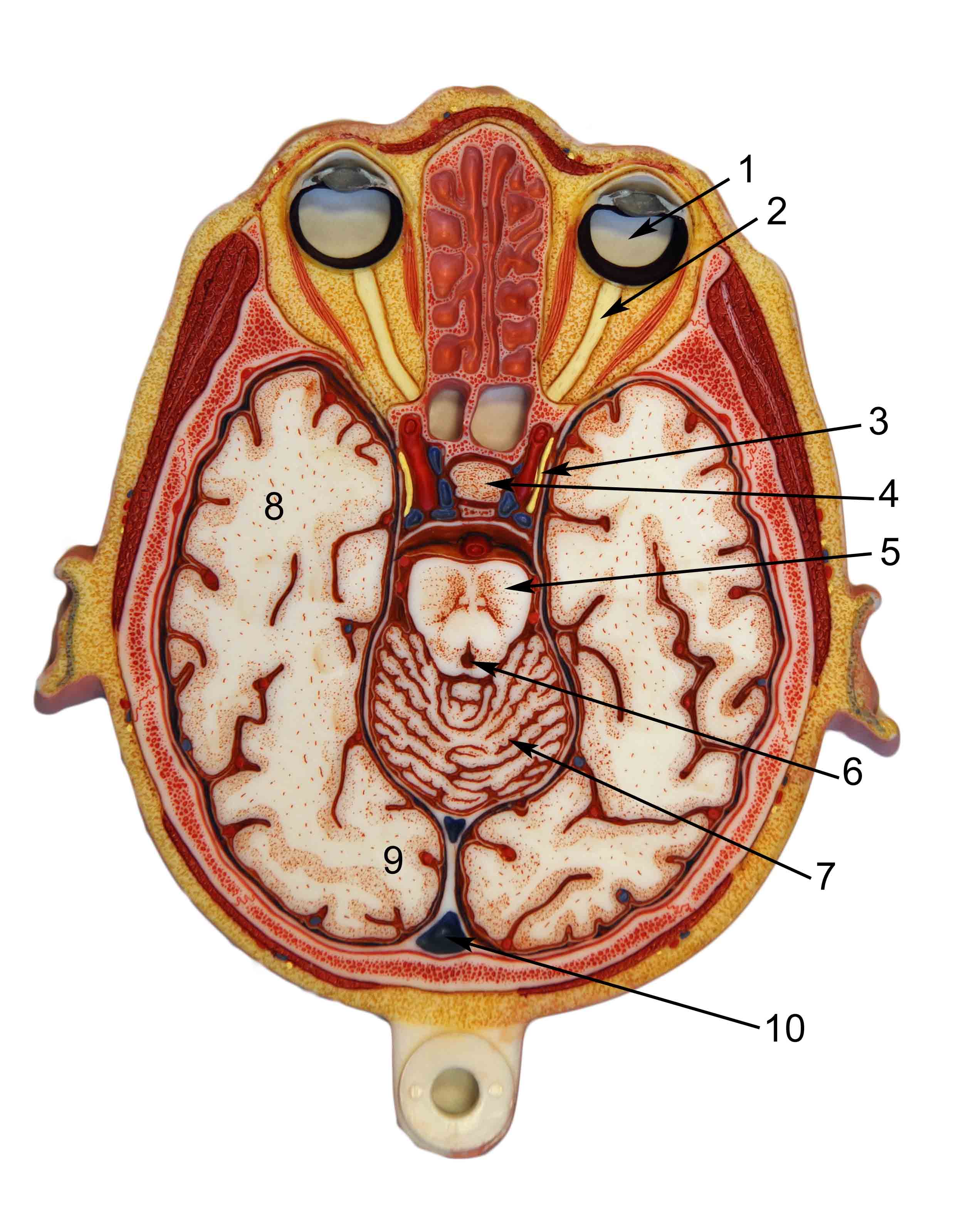 Brain Axial Section
