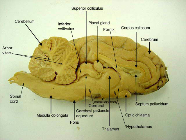 Function Of Arbor Vitae In Sheep Brain - Function Of Pons In Sheep Brain