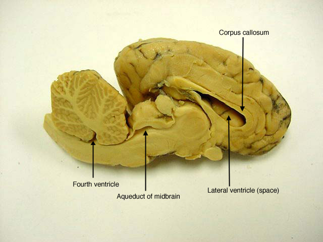 Label sheep brain