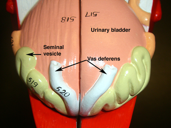 bladder model labeled