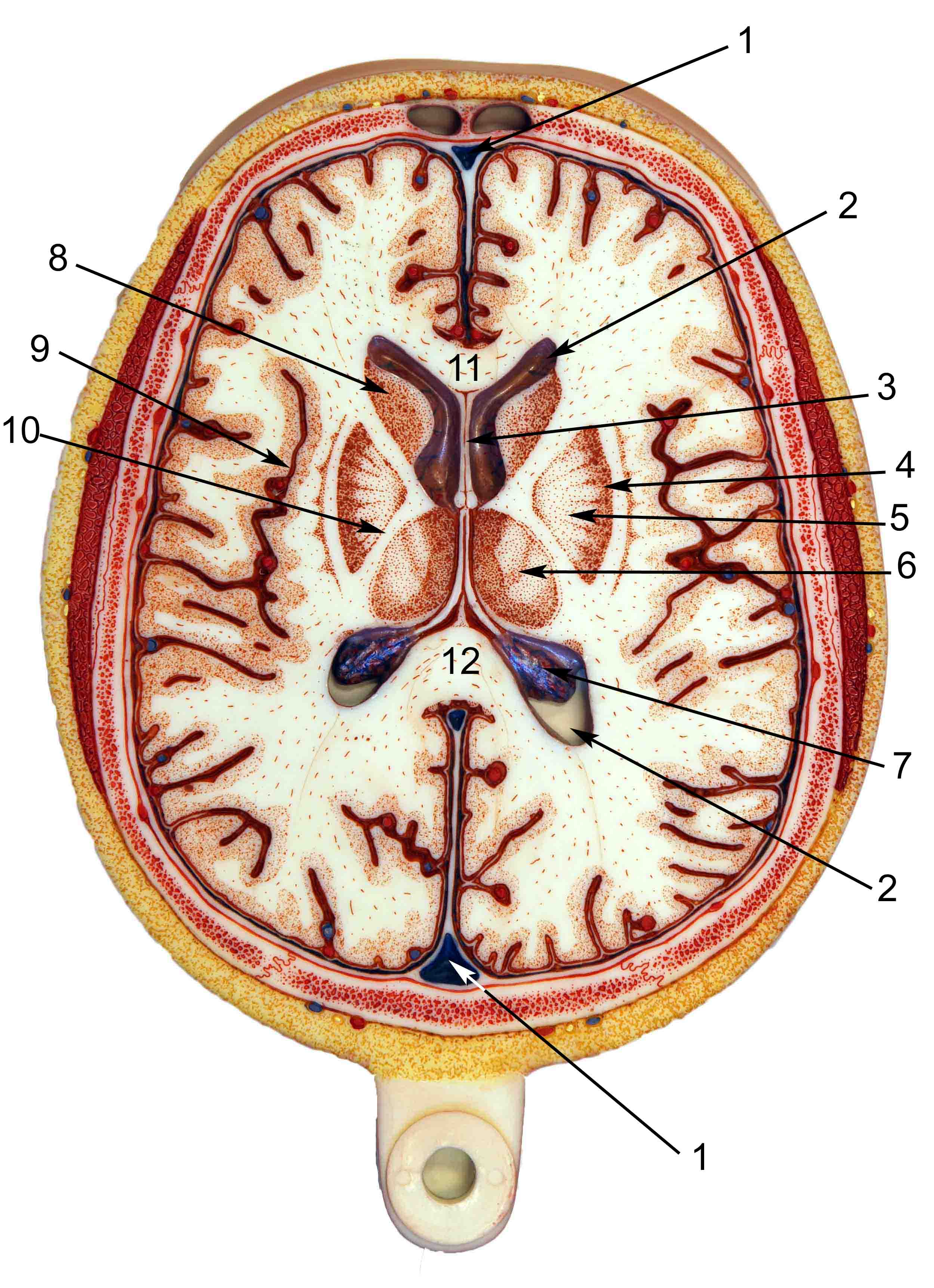 Brain Axial Section