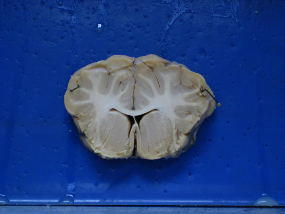 Sheep Brain