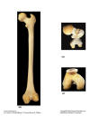 Femur-Posterior.jpg (65997 bytes)