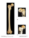 Femur.jpg (64943 bytes)