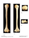 Humerus.jpg (73971 bytes)