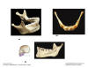 Mandible_and_Hyoid.jpg (71052 bytes)