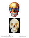 Skull_Anterior.jpg (86573 bytes)