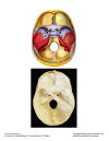 Skull_Internal.jpg (101134 bytes)