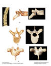 ThoracicVertebrae.jpg (102674 bytes)