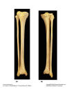 TibiaandFibula.jpg (70966 bytes)